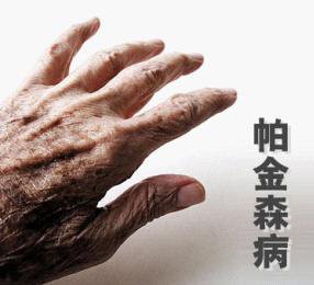 如何照顾帕金森患者